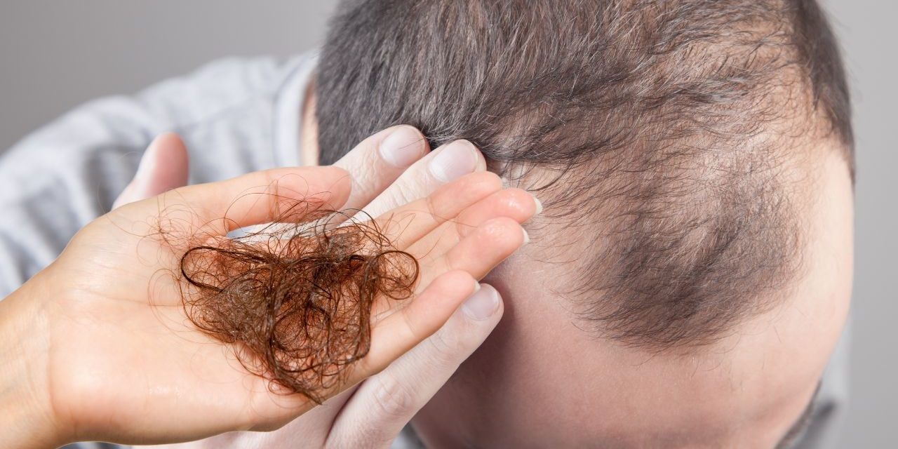 Hair Diseases